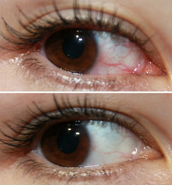 Ocuvit funktionnéiert ganz séier